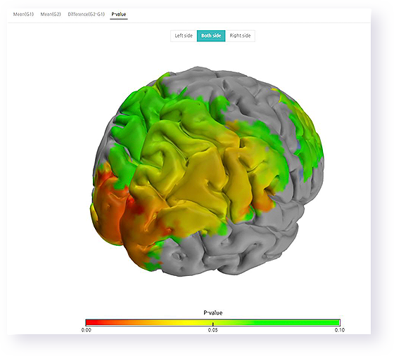sub_isyncbrain_data-3D1