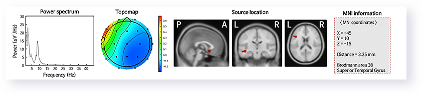 sub_isyncbrain_data-TeamUP3